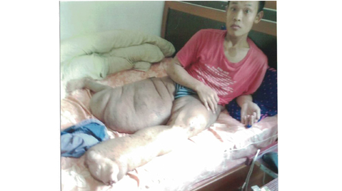 一位残疾患者最后的求助